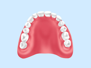 保険診療の入れ歯