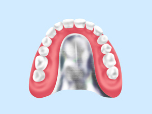 自費診療の入れ歯